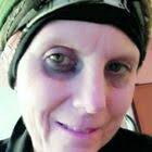 «Ho il tumore, devo curarmi». Daniela ritrova la mamma e chiede aiuto ma  lei rifiuta la trasfusione