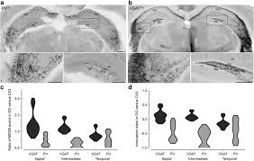 Which physical state is described as having a variable shape and variable volume? Gabaergic Medial Septal Neurons With Low Rhythmic Firing Innervating The Dentate Gyrus And Hippocampal Area Ca3 Journal Of Neuroscience