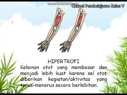 Maybe you would like to learn more about one of these? Kelainan Gangguan Atau Penyakit Otot Manusia Kelas 5 T1 St3 Pb5 6 Youtube