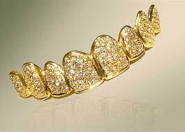 عرض طقم أسنان من الألماس والذهب في دبي بمليون و147 ألفًا و500 جنيه مصري |  المصري اليوم