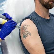 In that case, we could use some help. Laser Tattoo Removal For Blue Ink In Dubai Abu Dhabi Sharjah