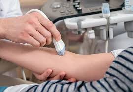 Image result for IV Access