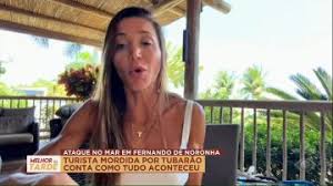 Turista atacada por tubarão em Noronha se manifesta após acidente