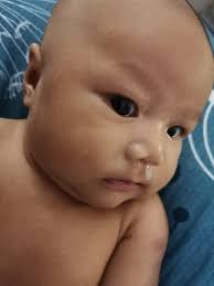 Batuk berkahak lazim dialami individu namun apakah punca kahak berwarna hijau, kuning atau ah, geramnya! Cik Orkid Cara Keluarkan Hingus Dan Kahak Bayi