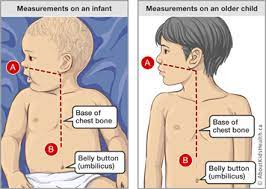 We did not find results for: Nasogastric Ng Tube How To Insert Your Child S Ng Tube