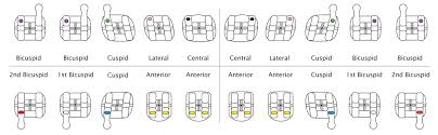 Pinnacle Roth Id Ortho Technology