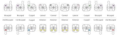 Pinnacle Bracket System Roth And Mbt Rx Ortho Technology