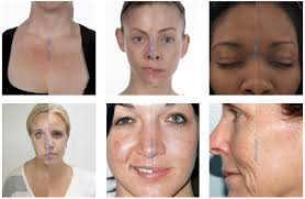 PMD Personal Microderm Review!