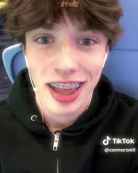 Connor Mls Ig
