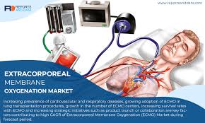 Ecmo stands for extracorporeal membrane oxygenation. Extracorporeal Membrane Oxygenation Ecmo Market To Reach Usd 371 8 Million By 2026 Getinge Group Medtronic Plc Livanova Plc Xenios Ag Medgadget