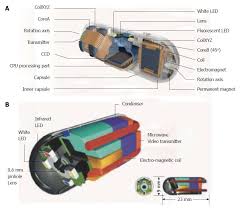Image result for Wireless Capsule Endoscopy