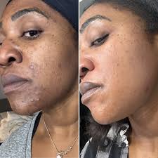 Heather Cyr (@med.aesthetics.heather) · Instagram photos and Reels