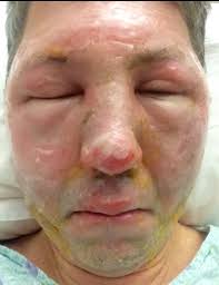 Fundraiser for Heather Wenzel by Julie Schillinger : Jamie's Recovery