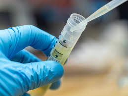 Maybe you would like to learn more about one of these? Yeast Infection Vs Uti Symptoms Causes Treatment Prevention