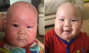 If you aren't sure about the right way to go about things, we have put together some pointers to help you learn how to wash a newborn baby's face. Eczema Treatment Baby Cleared Eczema Rash On Face Using This Cream Express Co Uk