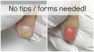Repairs are not only easier to do than soaking off the nail prep the exposed nail, fill in the area, cut the nail to the break, put a form underneath it, and step 1: How To Fix Damaged Nail With Acrylic Youtube