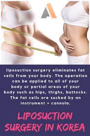 Liposuction In Korea