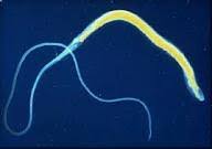 Because whipworm infestations can be hard to diagnose, veterinarians may prescribe a whipworm each tapeworm consists of many segments, though they only release the last ones in the chain as they are passed out of the dog's body. Whipworms And Other Worm Parasites In Dogs Inside Out Dog Training