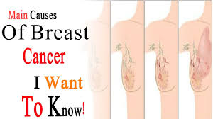How breast lumps feel depends on their cause, location, and growth. Main Reason Of Breast Cancer Can Being Pregnant Cause Breast Cancer How Do You Keep Your Breasts Healthy Steemkr