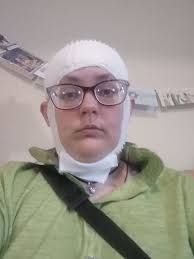 Waiting for results from a 72 hour eeg test