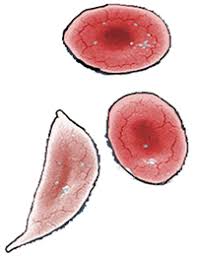 Use this to review various types of mutations. Students Use A Codon Chart To Compare The Dna Sequence Of Hba Normal Hemoglobin To Medical Laboratory Science Student Biology Experiments High School Biology
