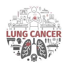 Women who have never smoked may be more at risk of developing lung cancer than men who have never smoked. Lung Cancer Banner Symptoms Causes Treatment Vector Signs For Web Graphics Stock Vector Illustration Of Surgery Cigarette 121464151
