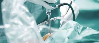 Operation Arthroskopie Knie