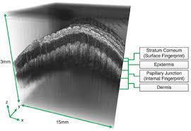 Example of an OCT scan volume. This is comprised of a series of image...