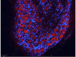 Get your free account now! Goat Anti Rabbit Igg Heavy Light Chain Antibody Atto 550 Preadsorbed Abin964987