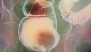 Irritable bowel syndrome (ibs) is a functional disorder of the digestive tract. Irritable Bowel Syndrome And Colorectal Cancer Cancer Therapy Advisor