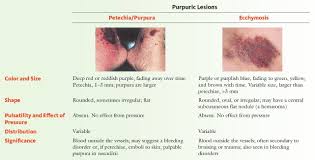 Petechiae are small, purpuric lesions up to 2mm across ecchymoses or bruises are larger extravasations of blood. Purpuric Skin Lesions Petechia Purpura And Ecchymosis Grepmed