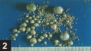 Ammonium Urate Urolithiasis Clinician S Brief