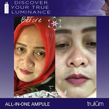 Trulum ampule in one ini adalah 1 produk dengan 5. Jual Trulum Skincare Di Sulabesi Timur Kepulauan Sula Wa 0811 233 8376 Trulum Merupakan Produk Skincare Perawatan Wajah Terlaris Perawatan Wajah Serum Toner