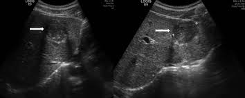 선정적인 사진 게시에 관한 규칙. ì ë¡ 