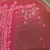 Antibiotic resistance of raoultella ornithinolytica: Https Encrypted Tbn0 Gstatic Com Images Q Tbn And9gcsafcxd98q51wk Dunxtw R96rkloy9yz En93smywjytlcvbqp Usqp Cau