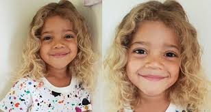 This condition is now called poliosis, but for years people like millianna and her entire family who  suffer  from this condition had no idea why it happened and doctors were clueless to help. Boy Born With White Skin And Blonde Hair Leaves His Jamaican And Asian Parents Stumped Practical Parenting Australia