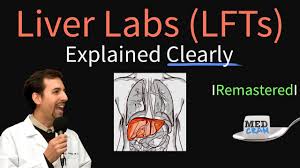 Liver Function Test Interpretation Lfts Liver Enzymes Remastered Bilirubin Ggt Alk Phos Youtube