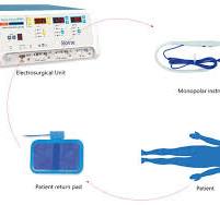 Monopolar VS. Bipolar Electrosurgery