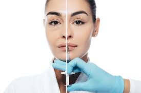 The dynamic wrinkles that your botox kept hidden show up again. Botox Fillers West Georgia Medicine Columbus Ga