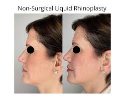 Injectables Showcase