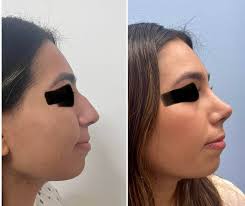 Dr.Carlo Pedroza Mendez