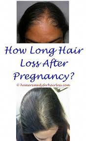 Hair Loss Avoidance Female Home Remedies Natural Treatments To Avoid Hair Loss And Also Advertise Hai Help Hair Loss Hair Loss Remedies Women Hair Loss Clinic