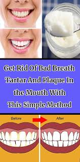 Get Rid Of Bad Breath Tartar And Plaque In The Mouth With This Simple Method Bad Breath Health Oral Health