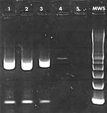 A holistic way to get rid of herpes. Polymerase Chain Reaction For Diagnosis Of Genital Herpes In A Genitourinary Medicine Clinic Sexually Transmitted Infections