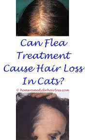 Home Remedies For Cats With Hair Loss Rosacea Hair Loss Blog Hair Loss By Bad Diet Permannent Copper Pept Accutane Hair Loss Body Hair Loss Eyebrow Hair Loss