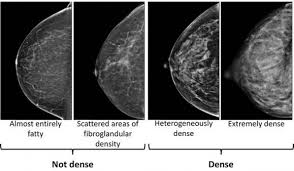 Recommendations made by the uspstf are independent of the u.s. What S The Best Way To Screen Dense Breasts Cancer Health