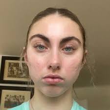 CELTIX HAUT-RICHELIEU