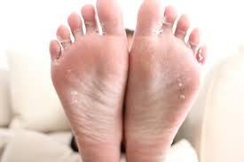 Por Que Se Pelan Las Plantas De Los Pies Y No Es Por Falta De Higiene