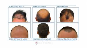 Just visit the usps website to learn how to find a post office near you. Trapianto Di Capelli In Italia E Meglio Che All Estero Ilgiornale It