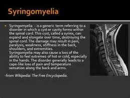 Definition Of Syringomyelia Autonomic Nervous System Dysfunction Chiari Malformation Spinal Cord
